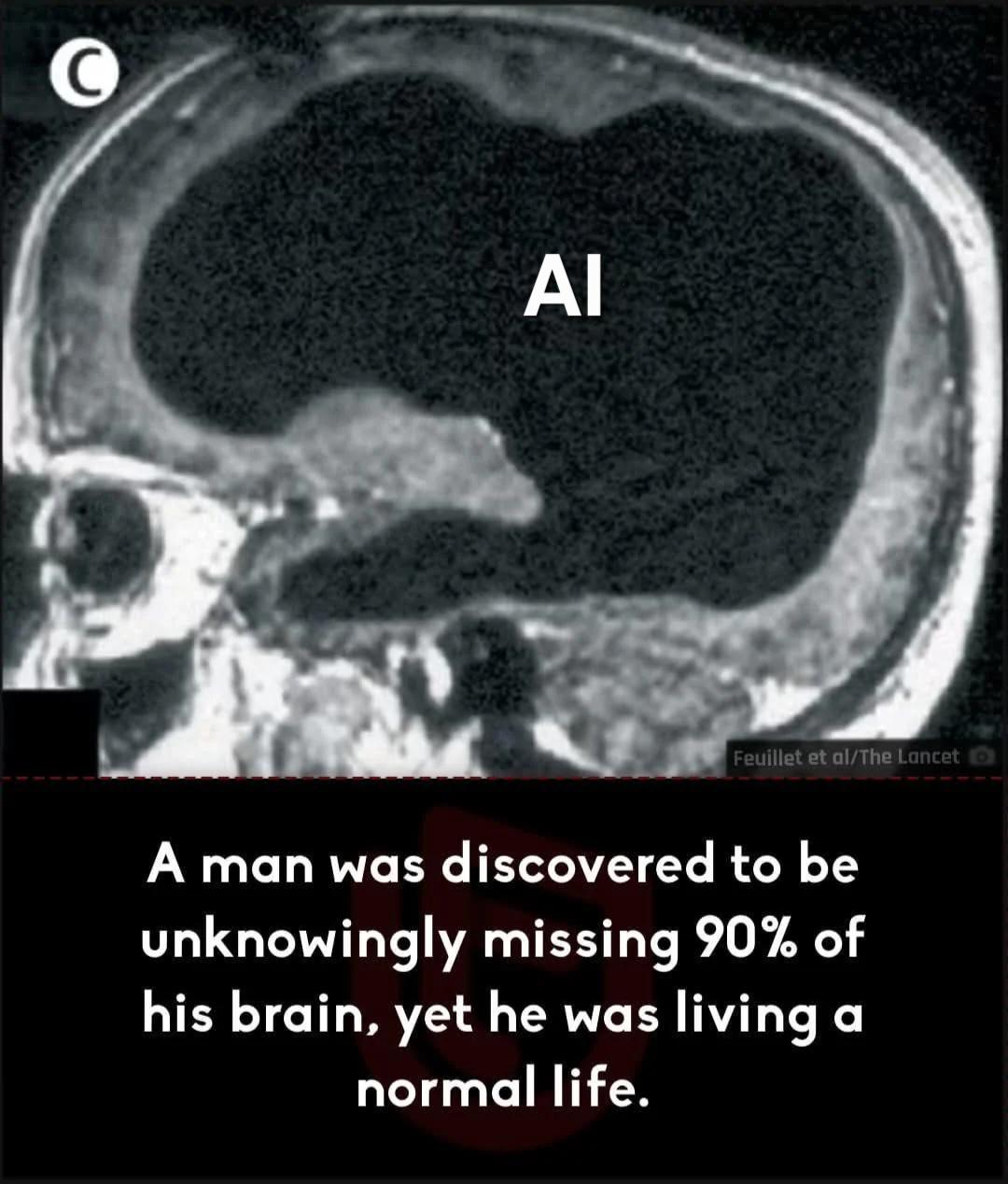 Who Needs A Brain When You Have AI?