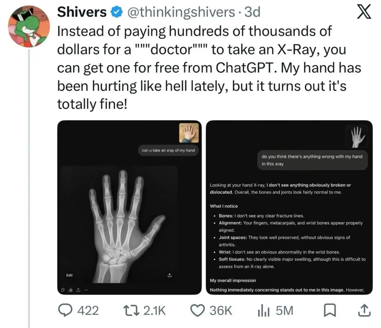 Free Xray